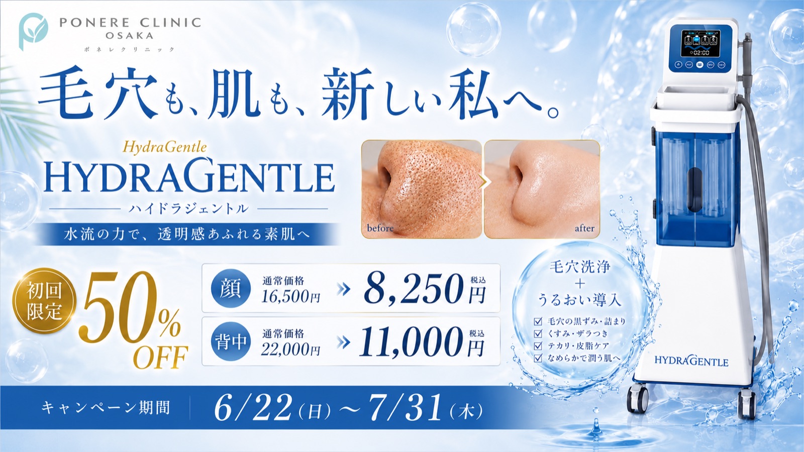 ハイドラジェントル 初回限定50%OFF